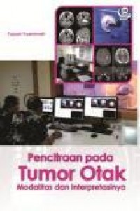 Pencitraan Pada Tumor Otak : modalitas dan interprestasinya