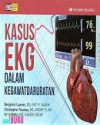 KASUS EKG DALAM KEGAWATDARURATAN